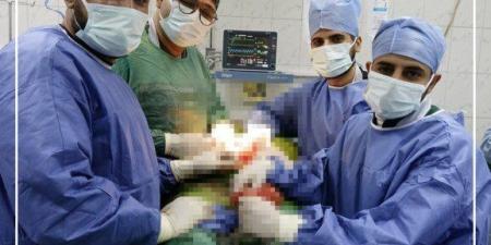 نجاة معجزة في المنيا.. فريق طبي بمستشفى الفكرية يُنقذ حياة سيدة من طعنة نافذة بالبطن - وضوح نيوز