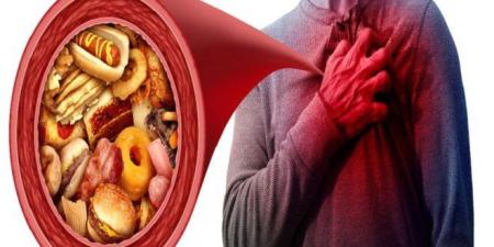 نتائج مفاجئة تعيد تقييم دور الدهون المشبعة في صحة القلب.. ما التفاصيل؟ - وضوح نيوز