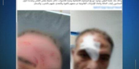 الداخلية تكشف تفاصيل الاعتداء على وكيل أحد المرشحين بالمنوفية - وضوح نيوز