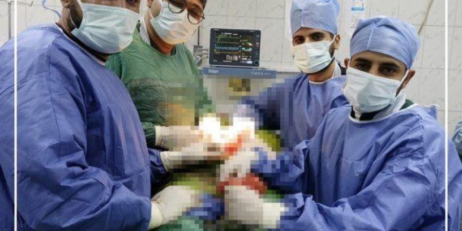 نجاة معجزة في المنيا.. فريق طبي بمستشفى الفكرية يُنقذ حياة سيدة من طعنة نافذة بالبطن - وضوح نيوز