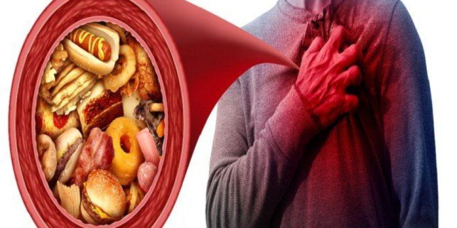 نتائج مفاجئة تعيد تقييم دور الدهون المشبعة في صحة القلب.. ما التفاصيل؟ - وضوح نيوز