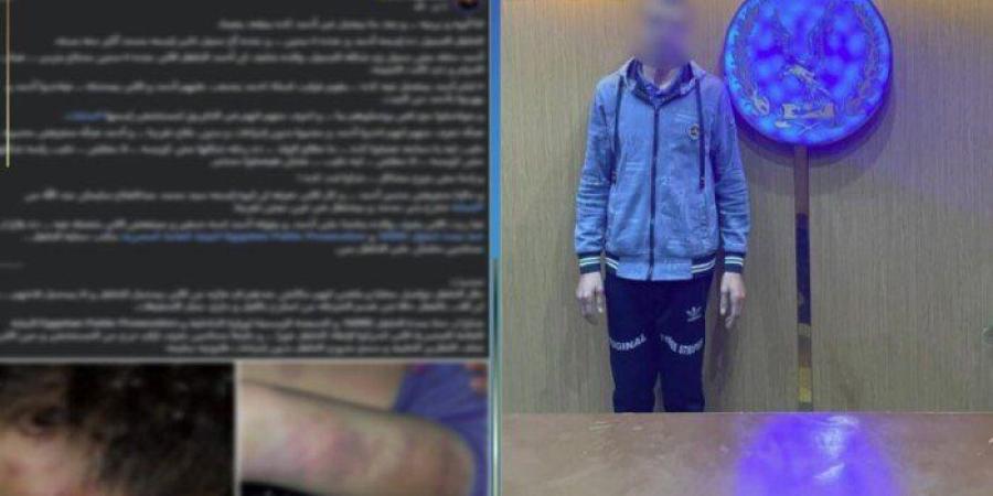 «كان بيأدبه».. ضبط المتهم بالاعتداء بالضرب على نجله وإصابته بالجيزة - وضوح نيوز