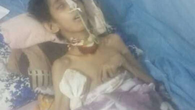 بعد حادث دهس مروع.. طفل من عدن يواجه حاجة ملحة للعلاج خارج البلاد لينقذه من وفاة محتملة