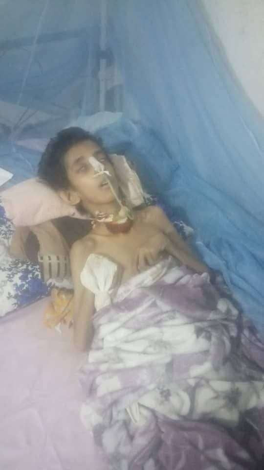 بعد حادث دهس مروع.. طفل من عدن يواجه حاجة ملحة للعلاج خارج البلاد لينقذه من وفاة محتملة